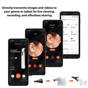 Ear, Nose & Throat Smart Wi - Fi Otoscope With Free Tools & Free shipping (Labor Day Special) - MOBI USA